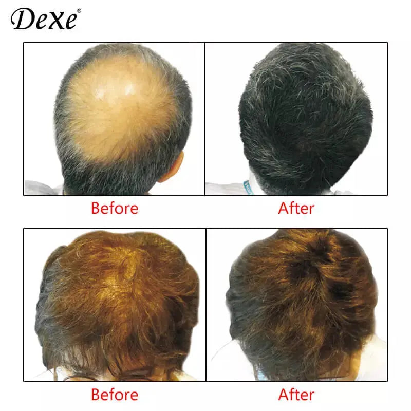 Dexe Hair Building Fibers 22g Imported Comfort Living